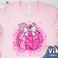 3987A_Breast Cancer